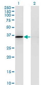 MDH1 Monoclonal Antibody (1D2)