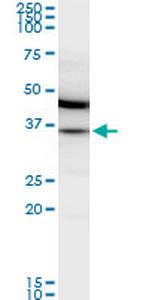 MDH2 Monoclonal Antibody (1G12)