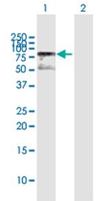 MECP2 Polyclonal Antibody, MaxPab™
