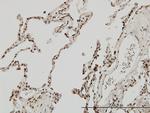 MEF2A Antibody in Immunohistochemistry (Paraffin) (IHC (P))
