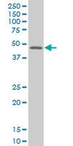 MEF2B Monoclonal Antibody (4B5)
