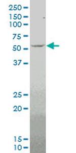 MEF2D Monoclonal Antibody (4D6)