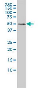 MEIS2 Monoclonal Antibody (1H4)