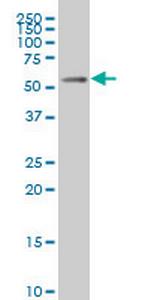 MEIS2 Monoclonal Antibody (1B3)