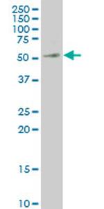 MEIS2 Antibody in Western Blot (WB)