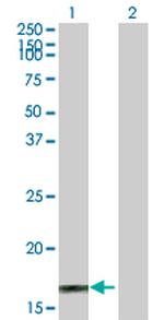 MAP3K3 Polyclonal Antibody, MaxPab™