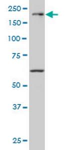 MAP3K4 Monoclonal Antibody (6C6)