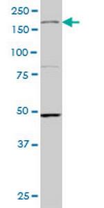 MAP3K4 Monoclonal Antibody (4C3)