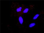 MAP3K5 Antibody in Proximity Ligation Assay (PLA) (PLA)