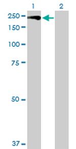 MAP3K5 Antibody in Western Blot (WB)