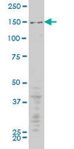 MAP3K5 Antibody in Western Blot (WB)