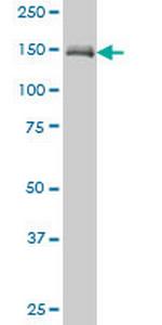 MAP3K5 Antibody in Western Blot (WB)
