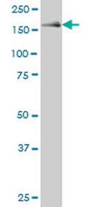 MAP3K5 Antibody in Western Blot (WB)
