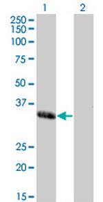 MEOX1 Monoclonal Antibody (2E12)