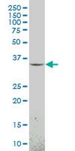 MEOX1 Monoclonal Antibody (1F3)
