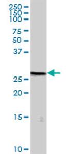 METTL1 Antibody in Western Blot (WB)