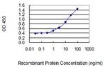 MGAT2 Monoclonal Antibody (6G5)