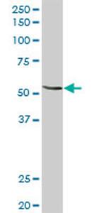 MGAT3 Antibody in Western Blot (WB)