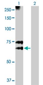 MGAT3 Polyclonal Antibody, MaxPab™