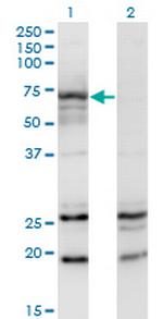 MGAT3 Monoclonal Antibody (2G4)