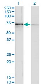 MGAT3 Monoclonal Antibody (1C9)