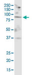 MGAT5 Monoclonal Antibody (3000000000)