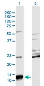 SCGB2A2 Monoclonal Antibody (3A4)