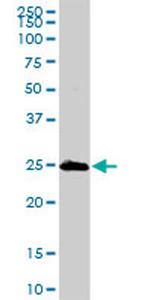 MGMT Antibody in Western Blot (WB)