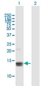 MGP Polyclonal Antibody, MaxPab™