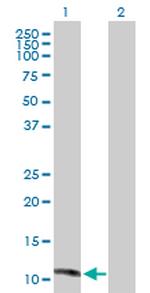 MGP Antibody in Western Blot (WB)