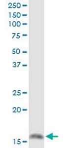 MGST1 Polyclonal Antibody, MaxPab™