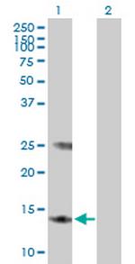 MGST3 Polyclonal Antibody, MaxPab™