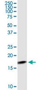 MGST3 Polyclonal Antibody, MaxPab™