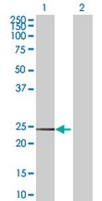 CD99 Antibody in Western Blot (WB)