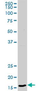 CD99 Antibody in Western Blot (WB)