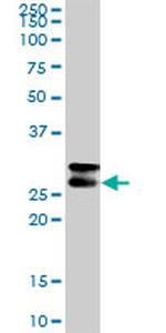 CD99 Antibody in Western Blot (WB)