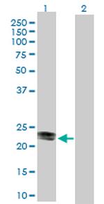 CD99 Polyclonal Antibody, MaxPab™