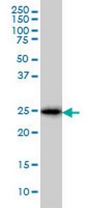CD99 Monoclonal Antibody (3A10)
