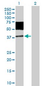 MICA Antibody in Western Blot (WB)