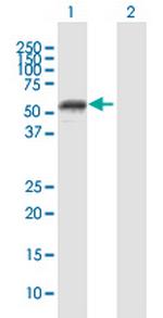 MMP1 Polyclonal Antibody, MaxPab™