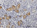 MMP1 Polyclonal Antibody, MaxPab™