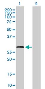 MMP7 Polyclonal Antibody, MaxPab™