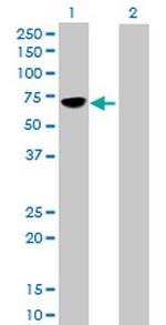 MMP8 Polyclonal Antibody, MaxPab™