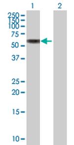 MMP8 Polyclonal Antibody, MaxPab™