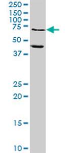 MMP10 Antibody in Western Blot (WB)