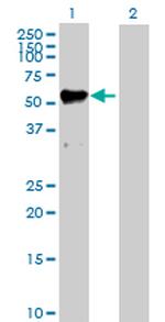 MMP12 Polyclonal Antibody, MaxPab™
