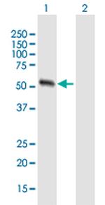 MMP13 Polyclonal Antibody, MaxPab™