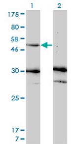 MMP13 Antibody in Western Blot (WB)