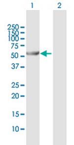 ALDH6A1 Polyclonal Antibody, MaxPab™