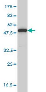 MPP1 Monoclonal Antibody (1C3-1D11)